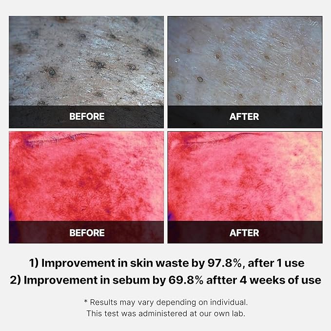 Medicube Red Succinic Acid Panthenol Facial Peeling Pads - Exfoliating Toner Pads for Breakout-Prone Skin with Niacinamide, AHA, BHA, and Soothing Panthenol - Non-Comedogenic