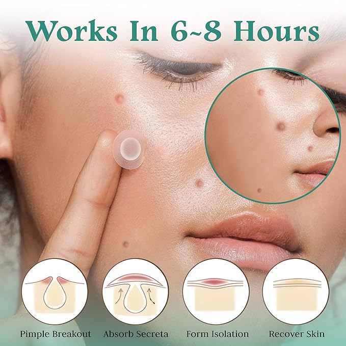 Advanced Invisible Pimple Patches for Face (96 Pack) - Hydrocolloid Patches with Tea Tree Oil - Vegan Friendly Acne Patches for Face - 2 Size Pimple Patch Stickers (10mm, 12mm)