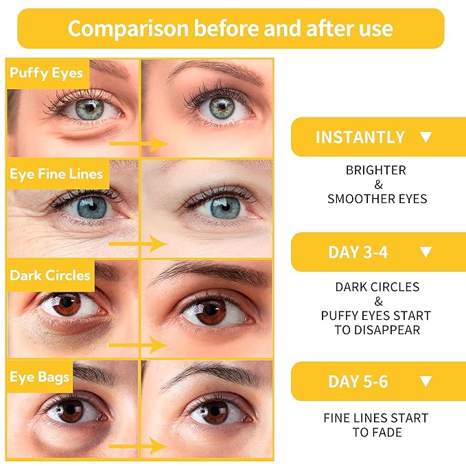 BREYLEE Under Eye Patches (30 Pairs), 24K Gold Eye Masks for Reducing Wrinkles and Fine Lines Under eye, Puffy Eyes and Dark Circles Treatments, Improve and Firm eye Skin, Pure Natural Extract