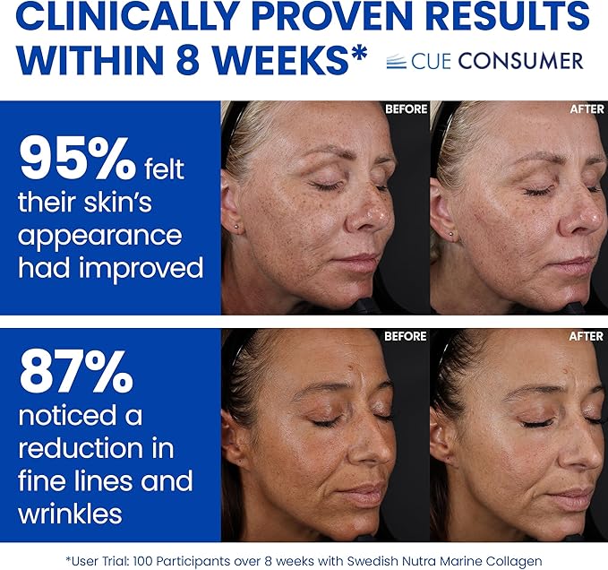 Swedish Nutra - Collagen Beauty | 10,000 mg Hydrolyzed Marine Collagen Liquid Supplement - 60 x 25 ml Daily Shots | Hyaluronic Acid and Vitamin C to Support Healthy Hair, Skin, Nails | Sugar-Free