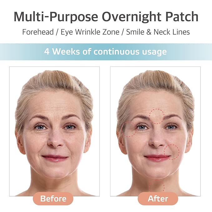 Forehead Wrinkle Patches – 8pcs | Labottach Korean Skincare Hydrogel Firming Patch for Between Eyes, Smile Lines & Fine Lines with Adenosine, Tartaric Acid | Stretch & Lift | Home Skin Care