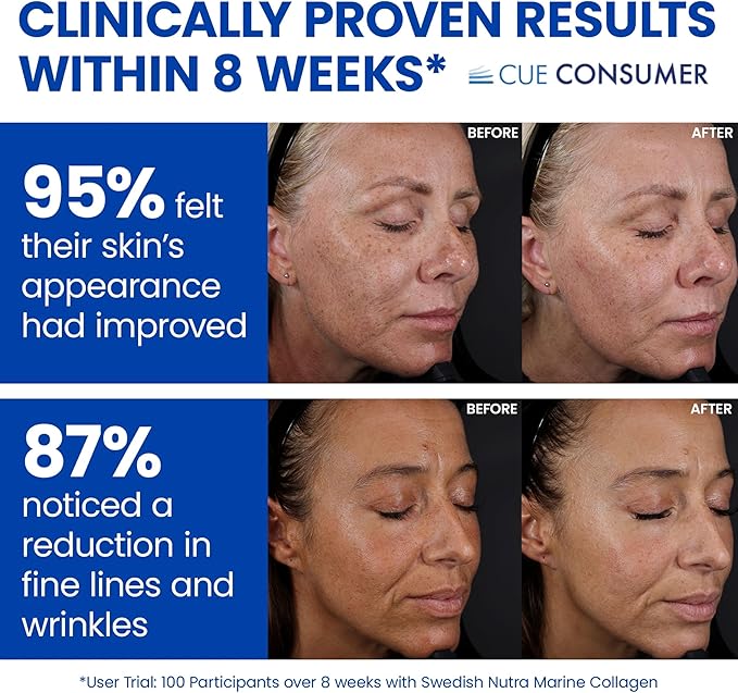 Swedish Nutra - 10,000 mg Hydrolyzed Marine Collagen Liquid Supplement - 500 ml, 20 Day Supply | Hyaluronic Acid, Biotin and Vitamin C to Support Healthy Hair, Skin, Nails and Joints | Sugar-Free