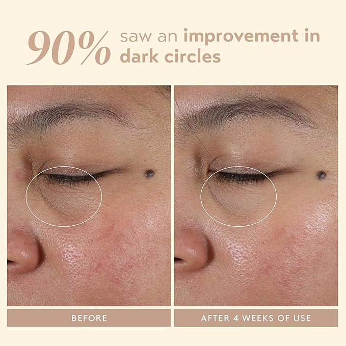 SHANI DARDEN SKIN CARE Intensive Eye Renewal Cream, Anti-Aging Eye Cream for Fine Lines, Crow’s Feet and Dark Circles, Crease-Free and Makeup-Ready, 0.50 fl oz