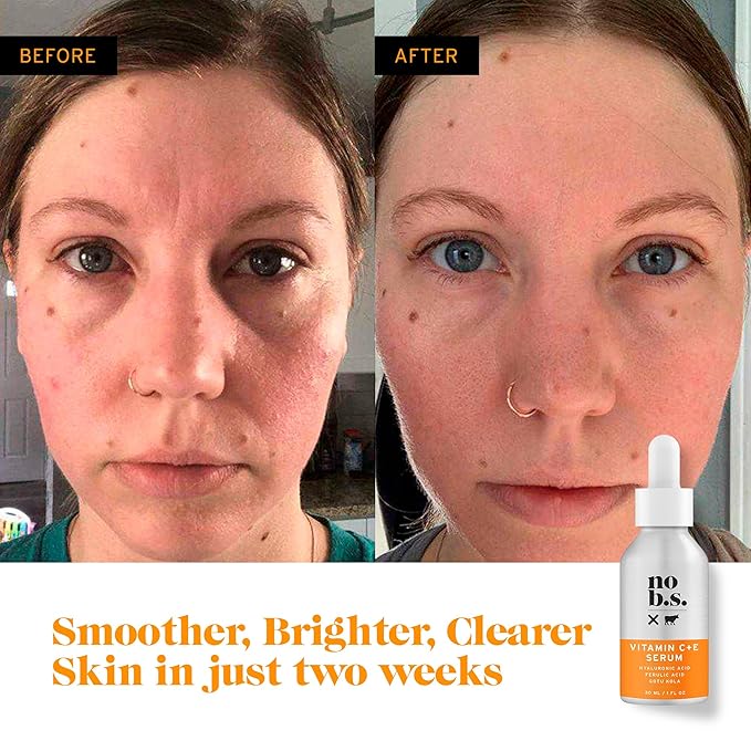 No Bad Stuff - Vitamin C + E Serum - Firming Face Serum for Anti-Aging, Smooths, Hydrates, Plumps Fine Lines & Reduces Dark Spots (1 fl oz)