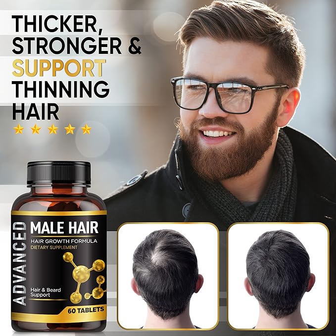 Hair Growth Vitamins For Men-Anti Hair Loss Support Vitamins Pills & Dht Blocker For Men.Regrow Hair & Beard Growth Supplement For Thicker Fuller & Stronger Hair. Support Thinning Hair With Biotin.