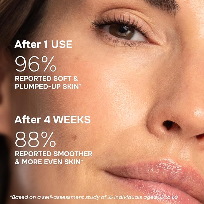 SimplyVital Moisturizer for Neck & Décolleté – With Collagen, Retinol, Peptides & Hyaluronic Acid – Anti-Aging Hydration – Made in USA – 1 fl.oz