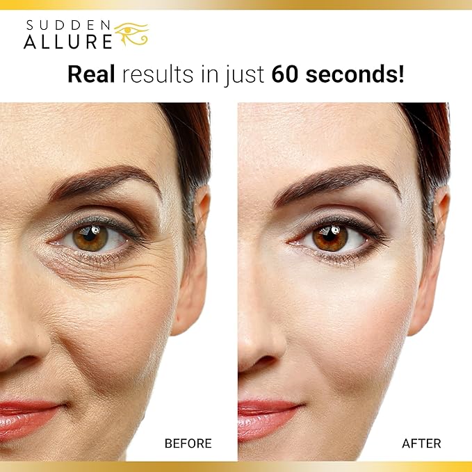 Sudden Allure Instant Under Eye Treatment Serum – Erase Under Eye Bags, Dark Circles, Wrinkles & Lift Sagging Eyes - Instantly Tighten & Firm - Reduce Eye Bags & Crows Feet | Made in USA (10 ml)