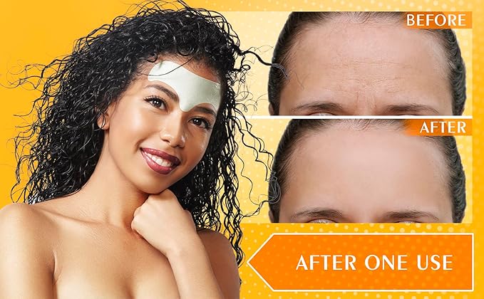 Forehead Wrinkle Patches with Hyaluronic Acid & Vitamin E - Anti Aging Face Pads for Smoothing Wrinkles - Hydrogel with Aloe & Collagen - 10 Patches