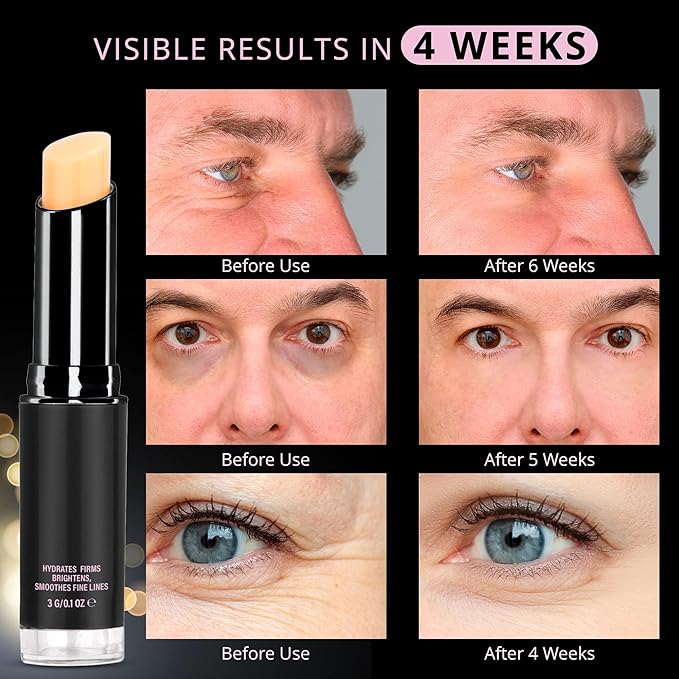 VELAMO ADVANCED Retinol Eye Stick: Retinol Eye Cream for Dark Circles and Puffiness with 1% Bakuchiol and Caffeine - Visibly Reduces Fine Lines Wrinkles Under Eye Bags with Upgraded Formula 0.1 OZ/3g