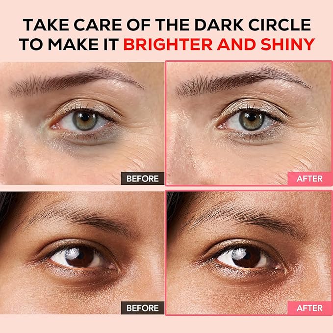 Olivia & Allison Dark Circle Corrector Eye Serum - Vitamin C, Squalane & Niacinamide for Brightening & Revitalizing (0.70 oz)