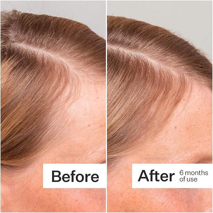 Act+Acre Cold Processed Stem Cell Scalp Serum - Promotes Thicker and Fuller-Looking Hair - Soothes and Hydrates the Scalp - Sulphate and Paraben Free - Aloe Vera for Improved Scalp Health.