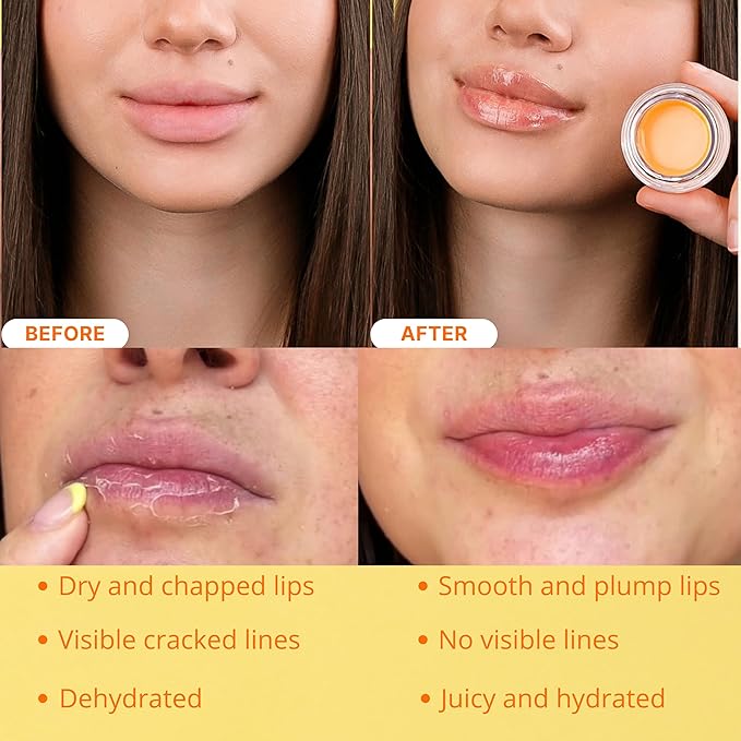 Original My Bee Balm Lip Balm - Peach Hydrating Balm Honey Pot for Dry, Chapped & Cracked Lips with Propolis, Honey & Vitamin E - Soften, Smooth & Reduce Lip Lines