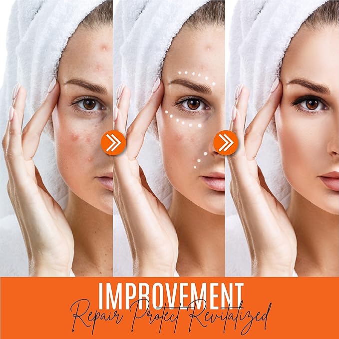 30% Vitamin C Serum (8 Fl Oz) Pure Organic Anti- Wrinkle + Hyaluronic Acid + Retinol + Vitamin E + Vitamin B, Facial Serum For Anti-aging, Wrinkles, And Fine Lines.