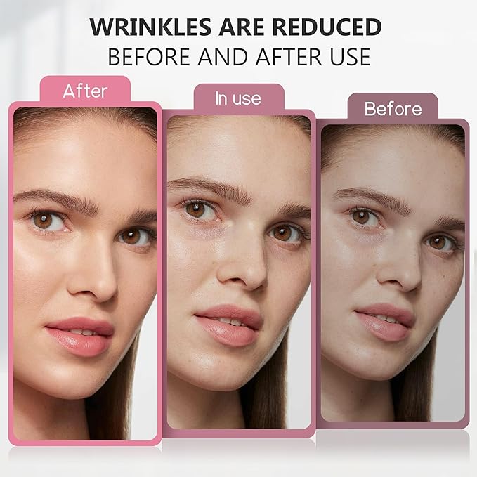 Face Anti Wrinkle Patches: Face Smooth Wrinkle Line - Overnight for Forehead Lines, Frown Lines, Crow’s Feet, Smile Line, Wrinkle Reduce for Women and Men 160pcs