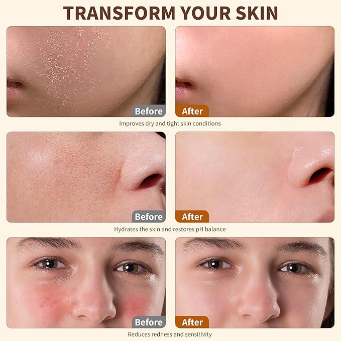 Beef Tallow for Skin, 100% Grass-Fed Whipped Beef Tallow Honey Balm for Face and Body, Tallow Face Moisturizer with Jojoba Oil, Shea Butter for Sensitive, Dry Skin - 2 oz