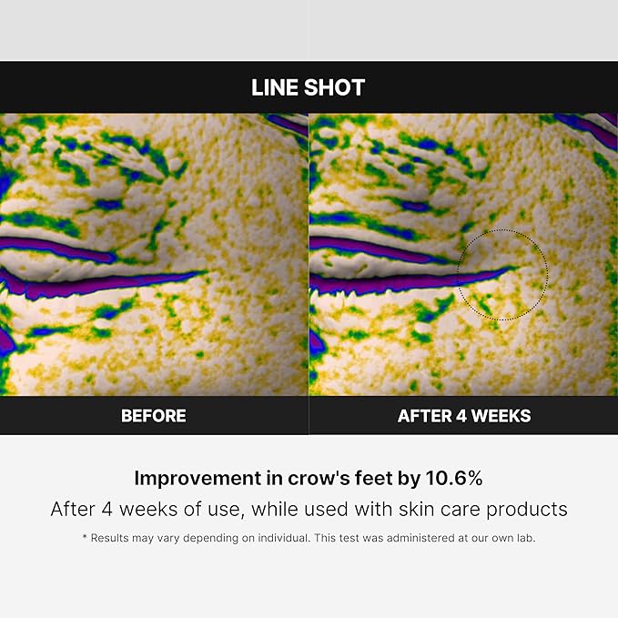 Medicube Age-R Line Shot - A Start of Effective Fine Lines Care Device for Smoothing Wrinkles Around Eyes, Lips, 11s, Neck, Plump Lips - Daily Anti-Aging Treament - Korean Skin Care