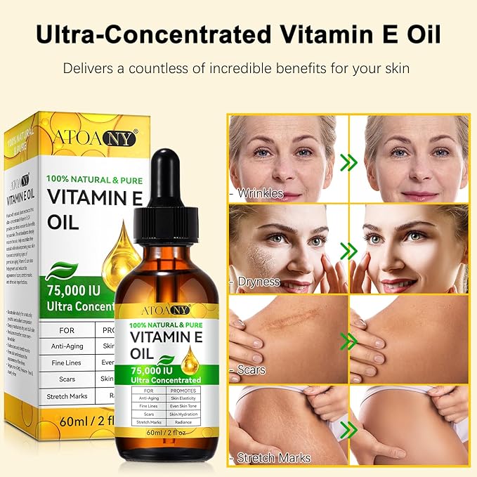Vitamin E Oil 75,000 IU - Pure & Natural Skin & Hair Care - Moisturizing for Face, Body, Sars and Scalp - Non-GMO, Gluten-Free, Paraben-Free