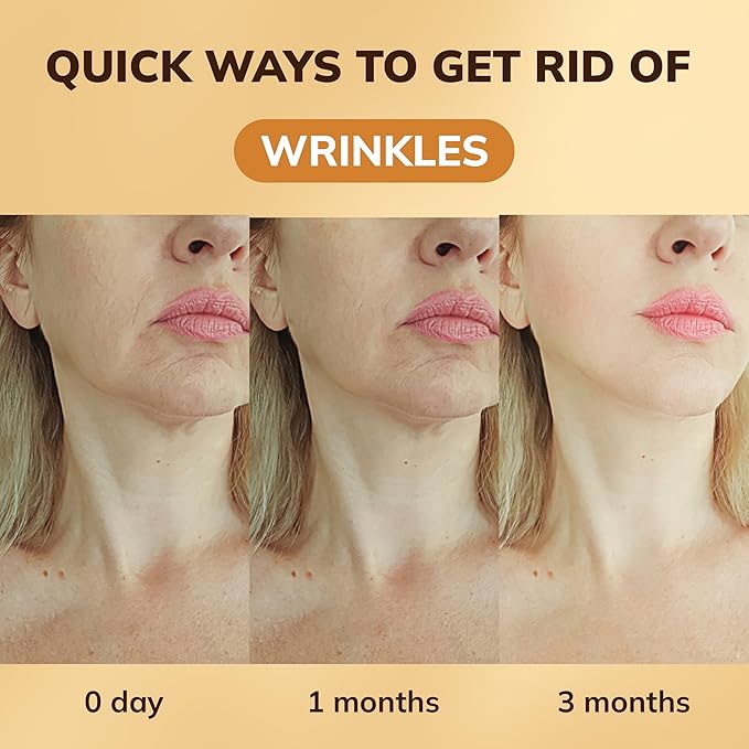 ABERA Gold Anti-Wrinkle Ampoule, Anti-Aging Serum For All Skin Type with Peach Extract and Hyaluronic Acid, Skin Firming & Firming Serum, Hydrating Serum (1 Ampoule)