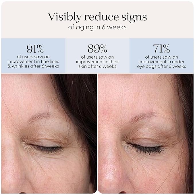 SmoothSkin Under-Eye Red Light Therapy Device, LED Eye Patches with 24 Hydrocolloids, for Dark Circles, Wrinkles & Puffiness