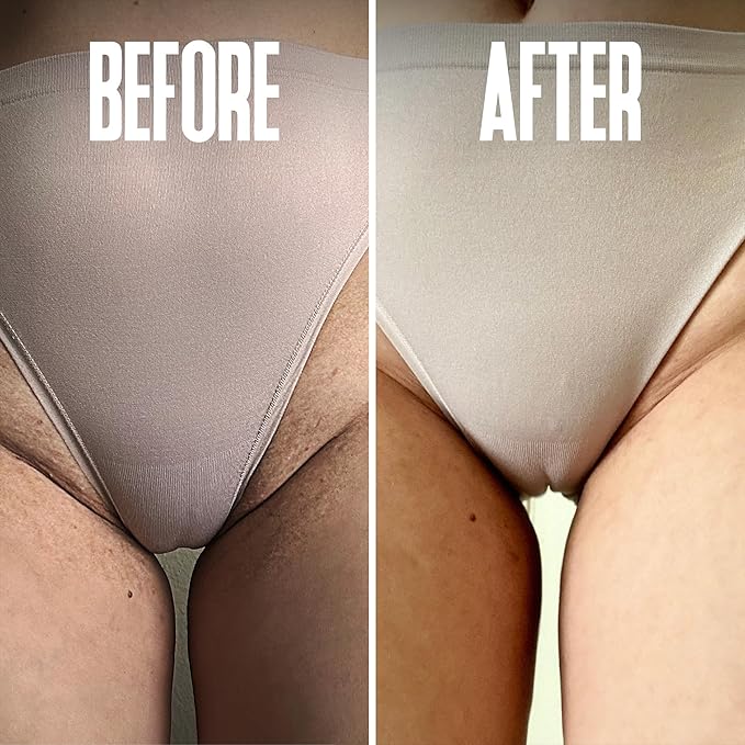 Save 18% on The Skin Care Solution For Dark Spots, Razor Bumps, Ingrown Hair & Razor Burns – Includes Our Ultra Potent Brightening + Razor Bumps Pads For an Ultra Clear & Glowing Skin