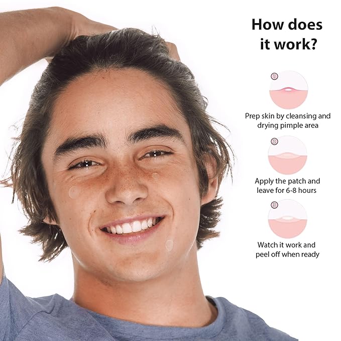 Frilliance Invisible Clear Circle Hydrocolloid Acne Pimple Patches for Zits and Blemishes (24 Count, 3 Sizes) Spot Treatment Stickers for Face & Skin, Vegan and Cruelty Free