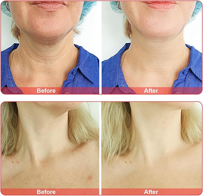 Electrode Wand Glass Tube Handheld Spare Parts Elitzia ETHB01 (Orange Y Shape)