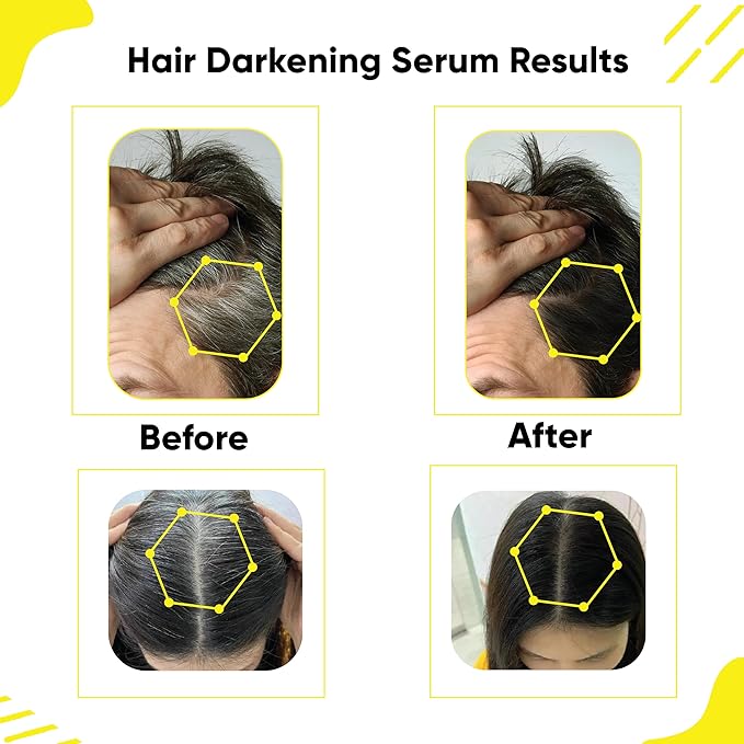 Masofta Hair Darkening Serum with Arcolys, Melano Gray, Biotin & Bhringraj for Promoting Darker, Shinier Hair and Beard, Suitable for Both Men & Women, 1.01 fl.oz./30 ml