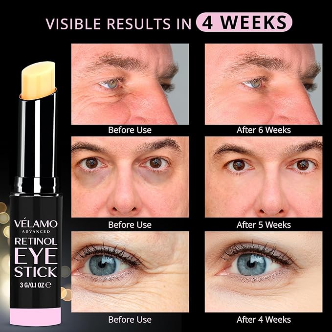 VELAMO ADVANCED Retinol Eye Stick: Retinol Eye Cream for Dark Circles and Puffiness with 1% Bakuchiol and Caffeine - Visibly Reduces Fine Lines Wrinkles Under Eye Bags with Upgraded Formula 0.1 OZ/3g