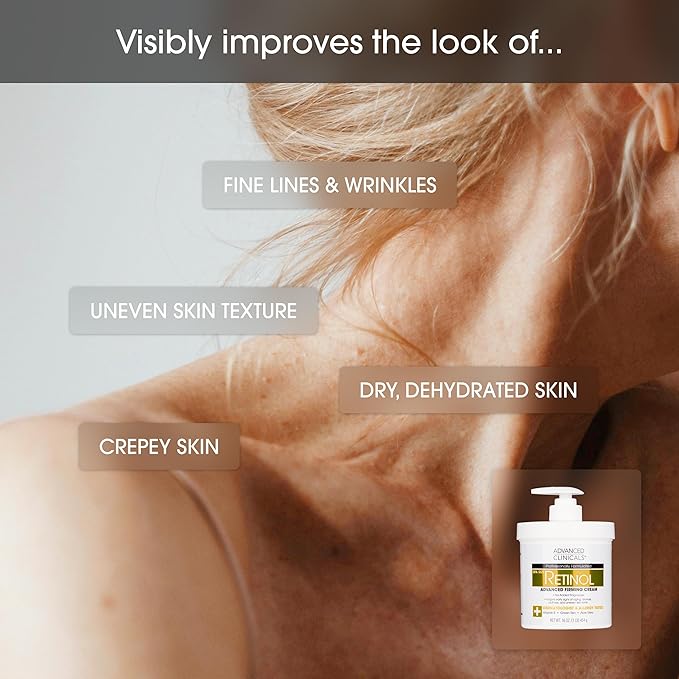 Advanced Clinicals Retinol Body Cream Moisturizer + Exfoliating 10% Glycolic Acid & Lactic Acid Lotion 2PC Skincare Set For Women & Men To Reduce Appearance Of Crepey Skin & Uneven Rough Skin Texture