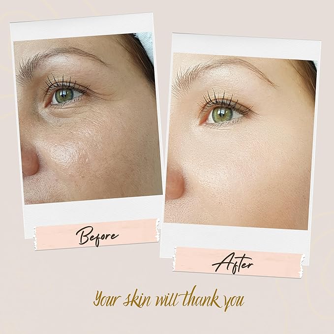 Anti-Aging Face Serum | 6-in-1 Facial Serum for Women | Hydrating, Brightening & Glowing Skin with Retinol, Hyaluronic Acid, Vitamin C & Collagen – Reduces Wrinkles & Fine Lines – 30ml