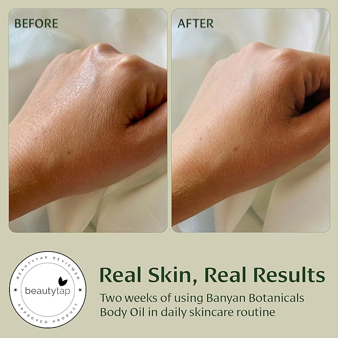 Banyan Botanicals Body Oil – Lightweight & Non-Greasy Body Oil – Ayurvedic Skin Care with Organic Jojoba Oil & Herbs for Soft, Smooth Skin – 4 oz – Non-GMO, Cruelty Free, Paraben Free Massage Oil