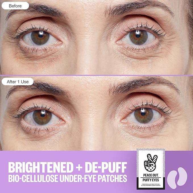 PEACE OUT Skincare Puffy Eyes, Biocellulose Under-Eye Mask, Minimize Puffiness & Tired Eyes with Caffeine and Niacinamide, Under Eye Patches for Dark Circles, 6 pairs