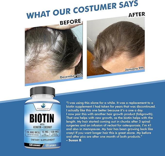 Biotin 20,000mcg with Keratin, Coconut Powder and Zinc, Hair Growth Supplements, Biotin Supplements, Healthy Hair Skin & Nails for Adults,120 Veggie Capsules, 120 Day Supply