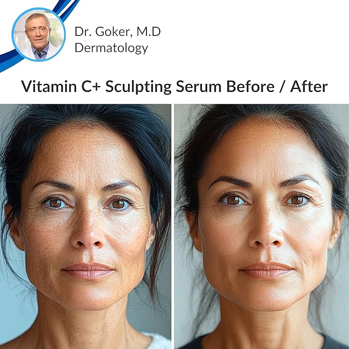 Levaye Vitamin C Serum – Anti Aging Facial Serum with Vitamin C, ferulic acid, Hyaluronic Acid, Vitamin E – Brightening Serum. Targets Dark Spots, Fine Lines, Wrinkles, Dry Skin, Firmness, 1.7 Fl Oz