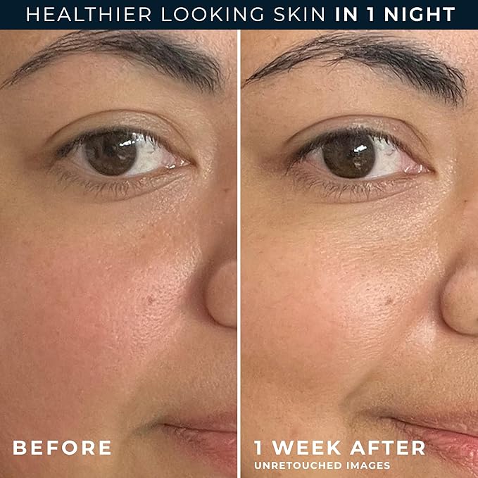 RoC Barrier Renew Night Moisturizer with Ceramides & Antioxidant Green Tea and Lipo Peptides to Renew Skin Barrier, (2.5 oz) with Retinol Eye Cream Packette