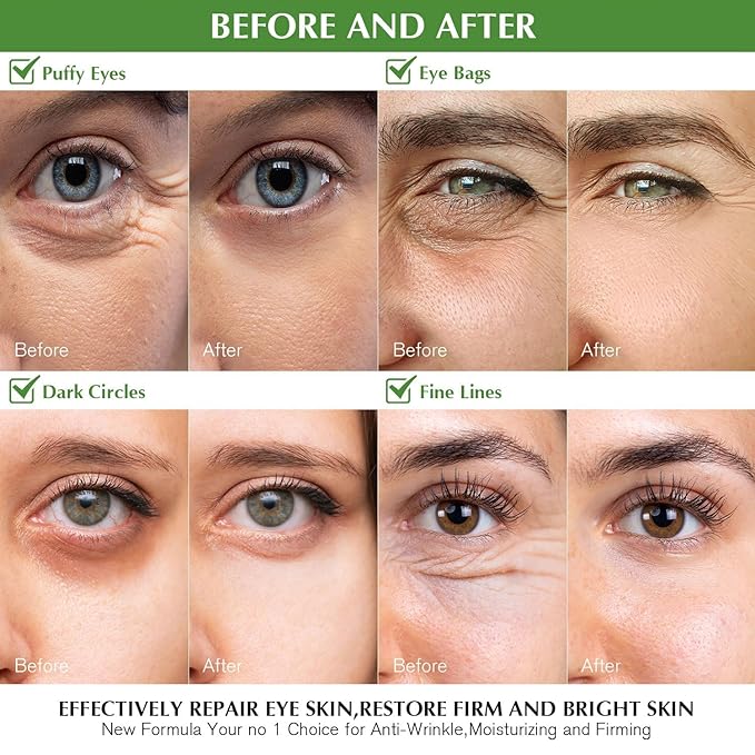 Under Eye Patches Dark Circles: 30 Pairs Collagen Eye Masks for Wrinkles and Puffy Eyes - Green Tea Eye Skin Care Gel Pads - Eye Bags/Fine Line Treatment for Men and Women