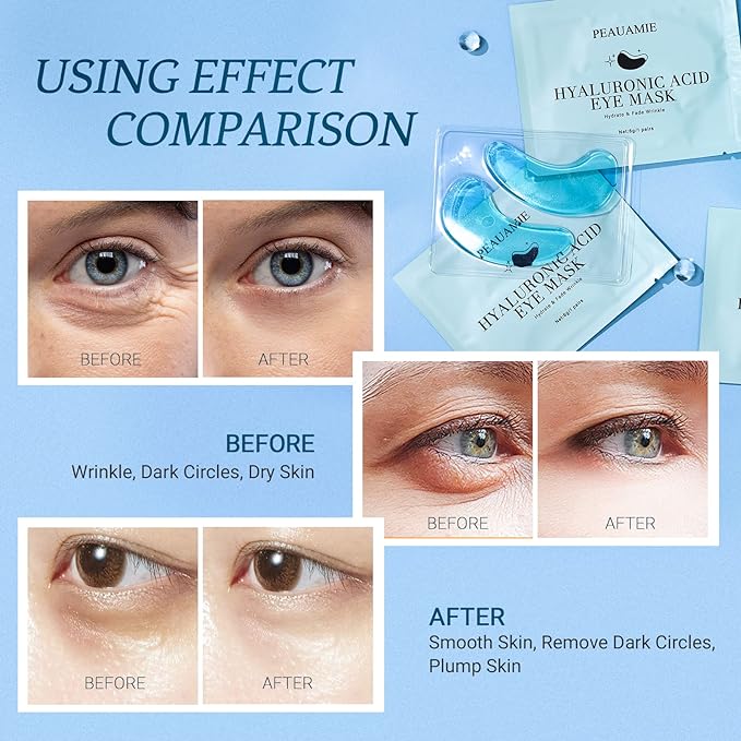 Under Eye Patchs Hyaluronic Acid Eye Mask for Dark Circles and Puffiness Wrinkle Eye Bags 30 Pairs