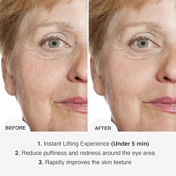 DermaSet Instant Face and Eye Lift | Face Skin Under Eye Tightening for Wrinkles, Lose Skin, Puffiness and Fine Lines | Fast Action Product within 5 Minutes | 0.51 Fl Oz (Pack of 1)