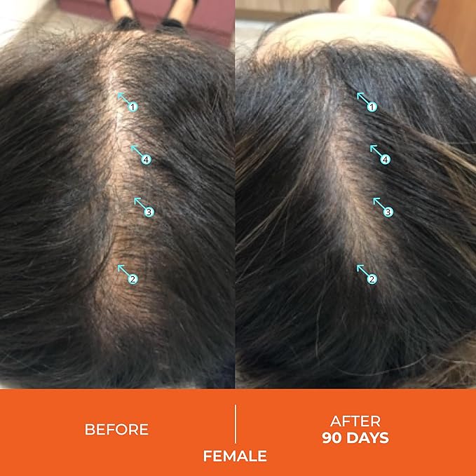 DS Laboratories Revita Hair Growth Gummies, Biotin, Vitamin D, Iron, Magnesium, Melatonin & Zinc Supplement, Vegan, Supports Thicker Hair Growth, Gluten Free (Packaging May Vary)