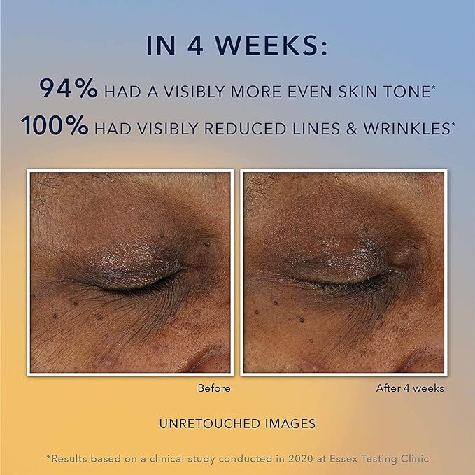 RoC Multi Correxion Revive + Glow 10% Active Vitamin C Serum for Face, Daily Anti-Aging Wrinkle and Skin Tone Skin Care Treatment, Brightening Serum, 1 Fluid Ounce