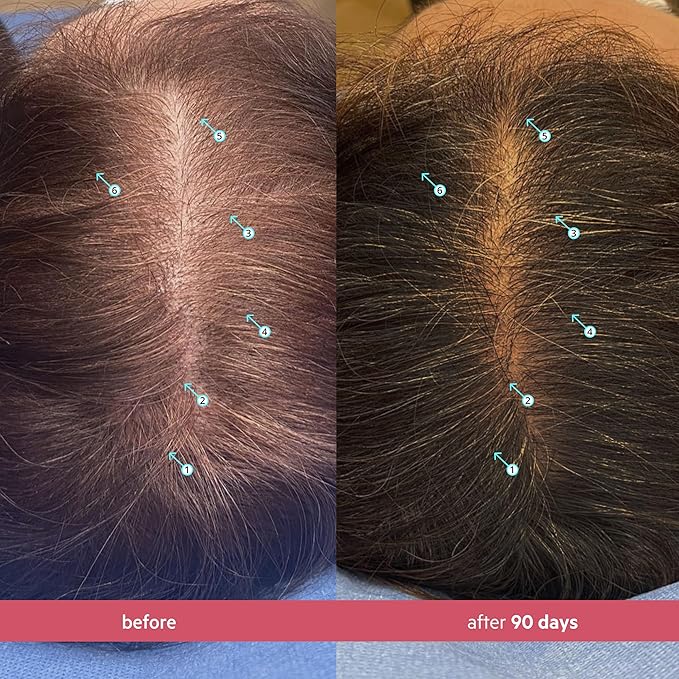 DS Labs Spectral Women's Formally Spectral.CSF - Hair Density Serum for Women, Thickening, Strengthening, Volumizing, Fuller-Looking Hair, 60mL, Packaging May Vary (Pack of 3)