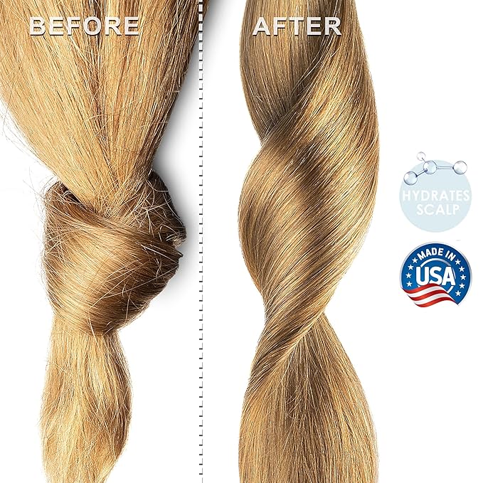 Australian Emu Oil | Triple Refined | 100% Pure & Natural Moisturizer for Skin & Hair Growth, Strengthener for Sensitive Skin, Body Oil | 12 fl oz