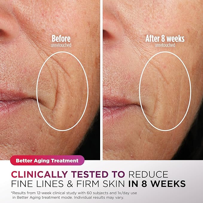 Shark CryoGlow LED Face Mask (FSA/HSA Eligible*) with Under-Eye Cooling, Anti-Ageing & Blemish Repair, Red & Blue LED, Infrared Light Therapy, USB-C, Remote Control, Storage Bag, Blue Frost, FW312